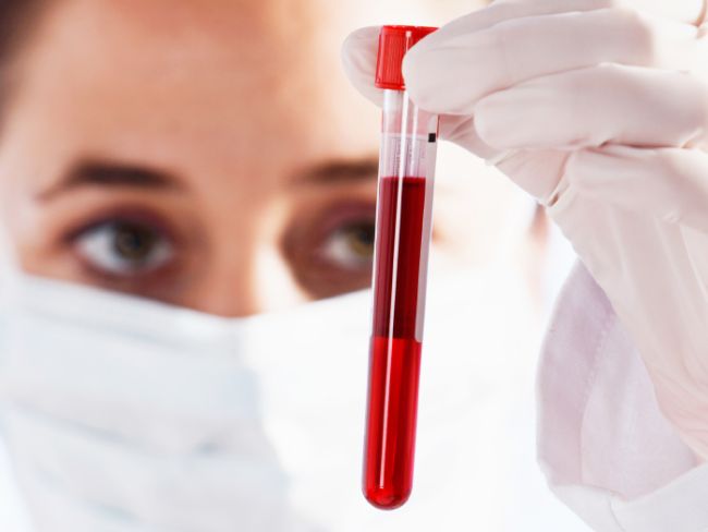 Katowice Badanie Krwi Laboratorium Cennik Godziny Pobierania Krwi Badania Medycznepl 6382